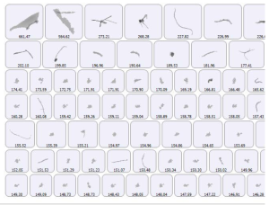 Análisis de morfología y cantidad partículas en anestesias.       
